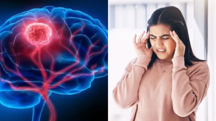 ब्रेन ट्यूमर से जुड़ी बातों को जानना जरूरी (Image Credit- Freepik)