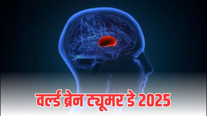 क्यों मनाया जाता है विश्व ब्रेन ट्यूमर डे (Image Credit- Freepik)