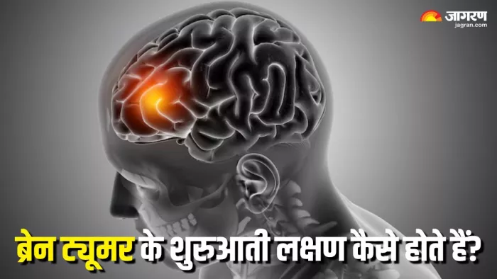 8 जून को मनाया जाता है World Brain Tumor Day (Picture Courtesy: Freepik)