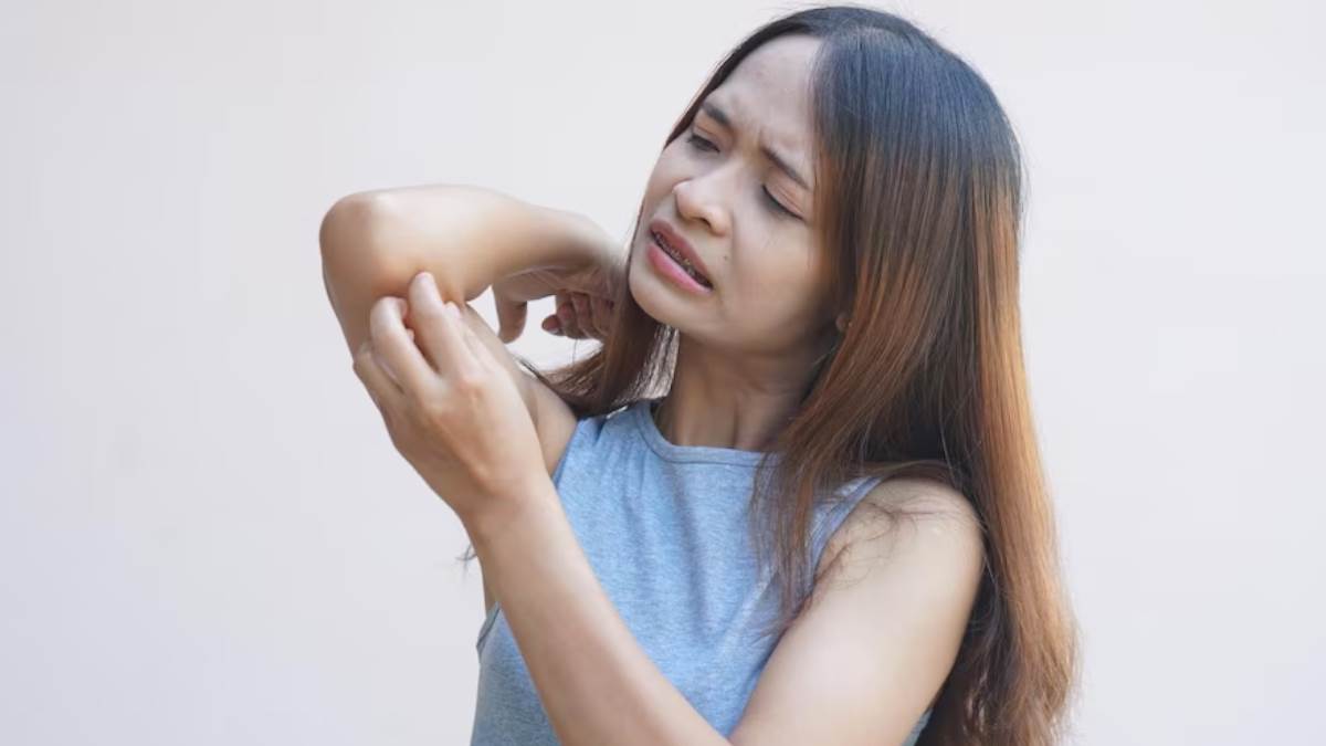 https://www.jagranimages.com/images/newimg/08072023/08_07_2023-monsoon_itching_remedies_f_23464894.jpg