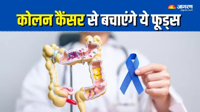 कोलन कैंसर का रिस्क कम करने के लिए फूड्स