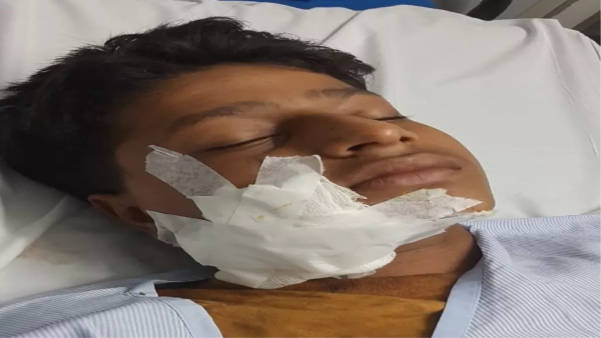 मेरठ में पिटबुल के हमले में घायल किशोर की हालत गंभीर, जबड़े की होगी सर्जरी