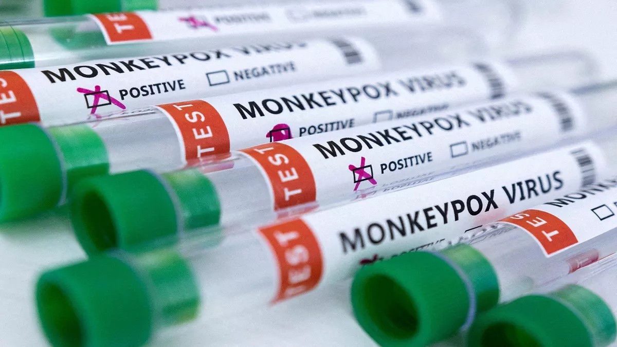 Monkeypox: यूरोप में फैले मंकीपाक्स संक्रमण से अलग है देश के पहले दो मामलों में मिला वैरिएंट, ICMR ने की पुष्टि