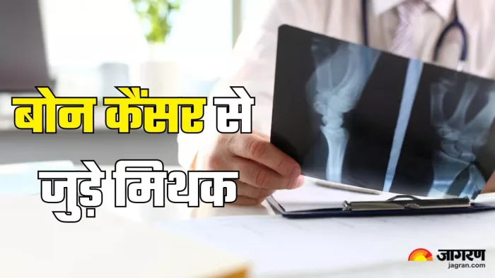 बोन कैंसर के मिथक और फैक्ट्स (Picture Credit- Freepik)