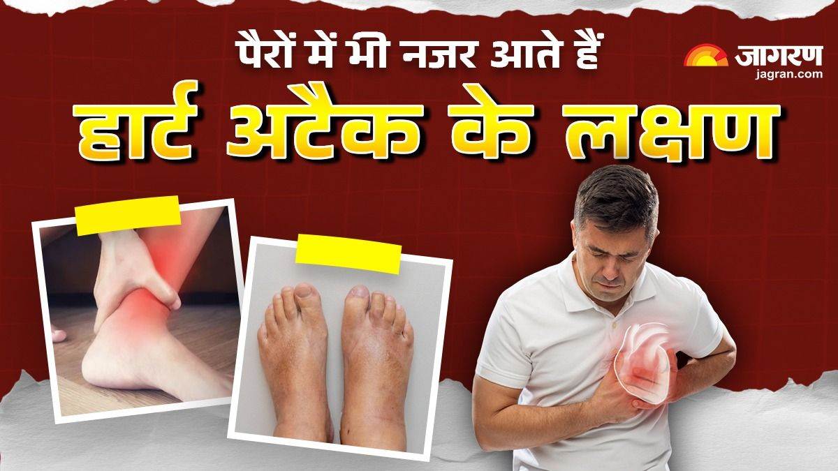https://www.jagranimages.com/images/newimg/08082025/08_08_2025-heart_attack_symptoms_in_leg_24007072.jpg
