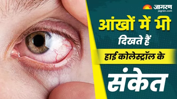 आंखें भी बताती हैं सेहत का हाल (Image Credit- Freepik)