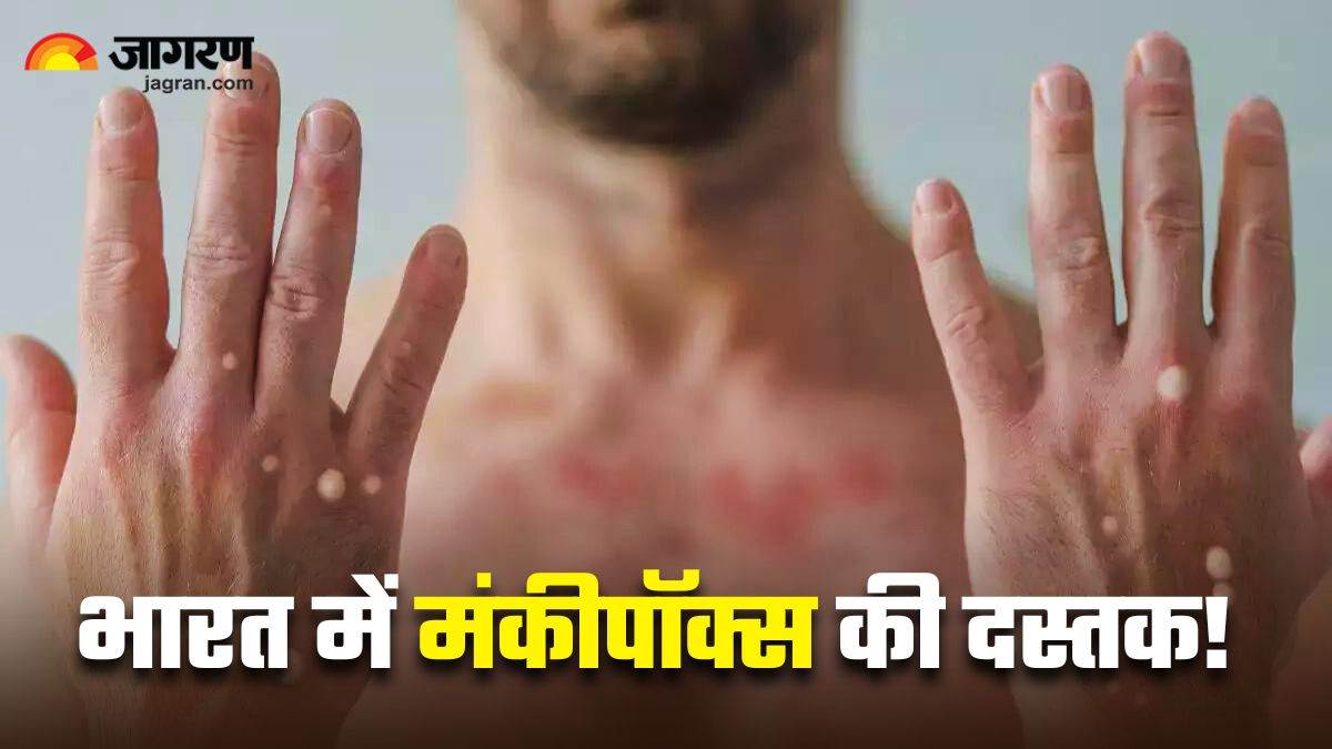 https://www.jagranimages.com/images/newimg/08092024/08_09_2024-monkeypox_in_india_23793269.jpg