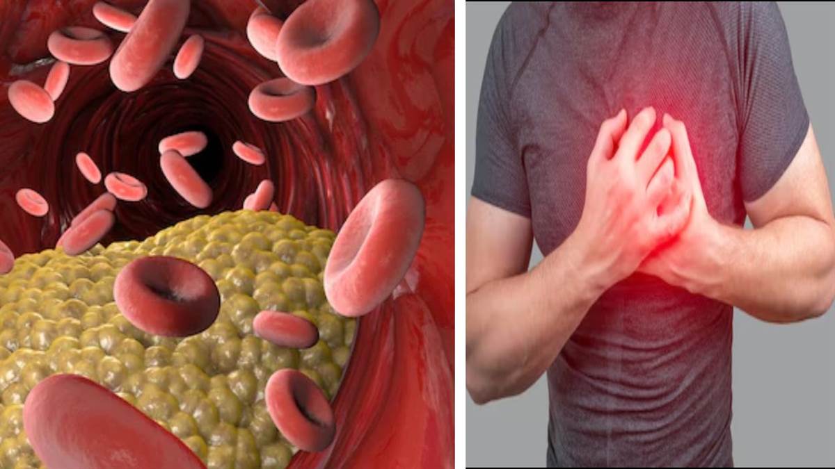 https://www.jagranimages.com/images/newimg/08092025/08_09_2025-cholesterol_alert_24040183.jpg