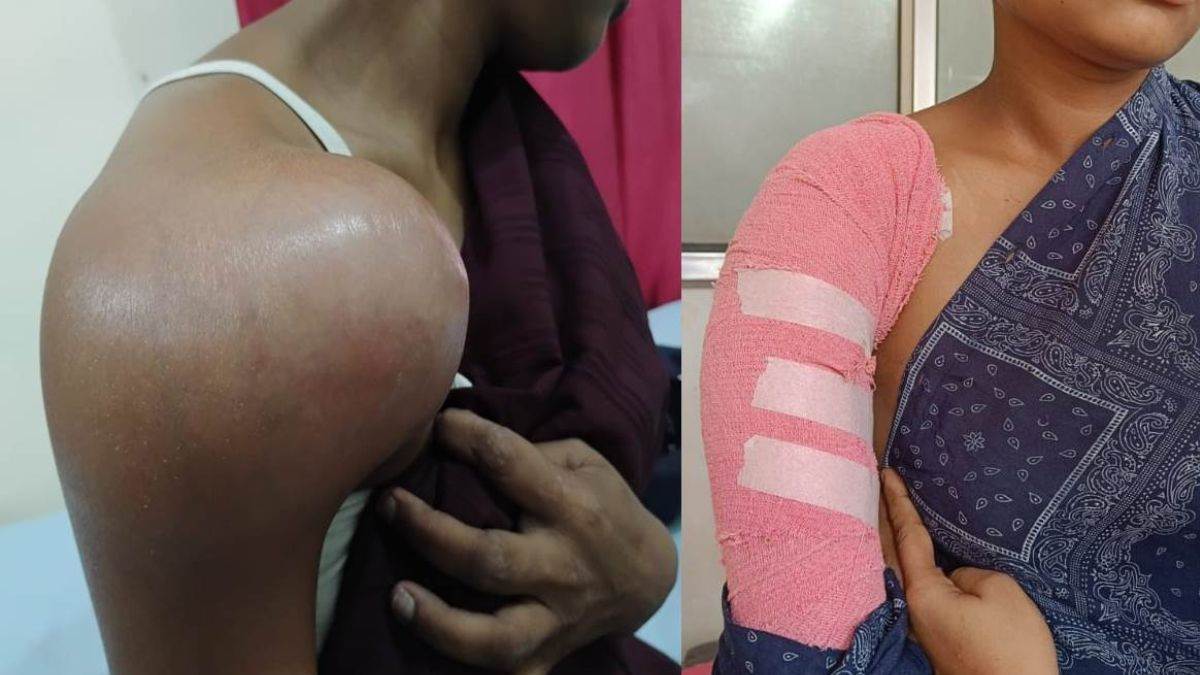 https://www.jagranimages.com/images/newimg/08092025/08_09_2025-surgery_24040074_175444519.jpg
