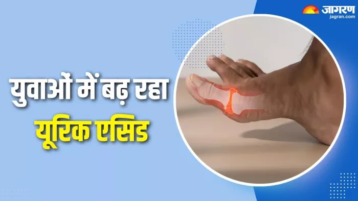 युवाओं में बढ़ रहा यूरिक एसिड कारण और लक्षण (Picture Credit- Freepik)