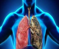 https://www.jagranimages.com/images/newimg/08112020/08_11_2020-lung_21038415.jpg