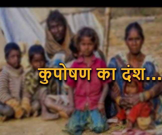 भारत में 33 लाख से अधिक बच्चे कुपोषित।(फोटो: प्रतीकात्मक)