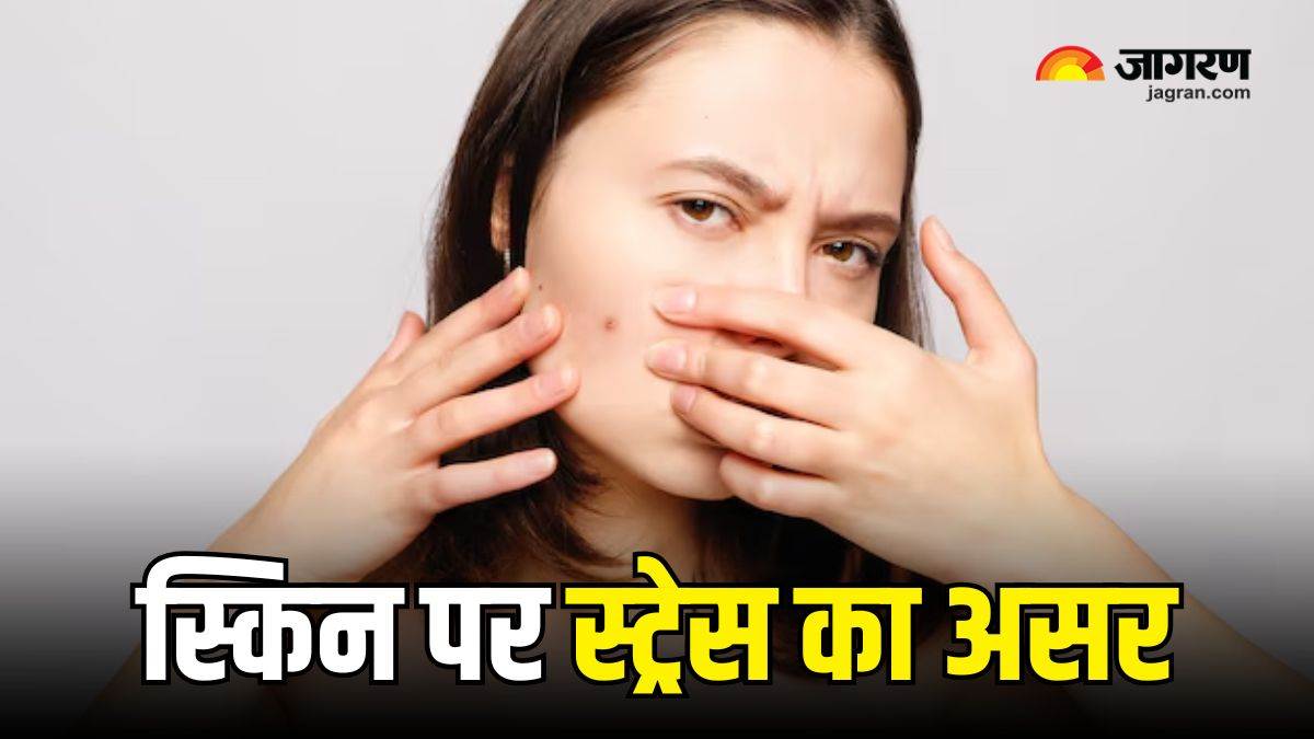 too much stress can take away the glow from your face keep these things in mind for protection