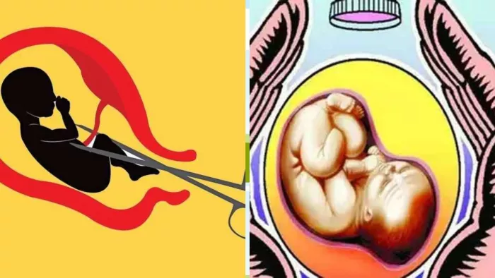 झारखंड में लिंग परीक्षण के मुखबिर को मिलेंगे एक लाख रुपये