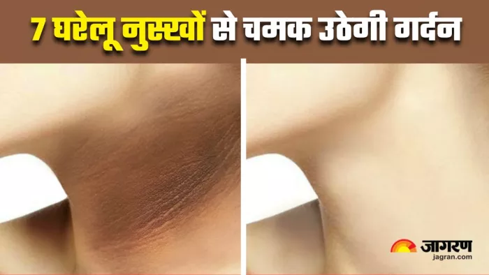 गर्दन पर होने वाली पिगमेंटेशन को दूर करेंगे 7 घरेलू नुस्खे (Image Source: Freepik)