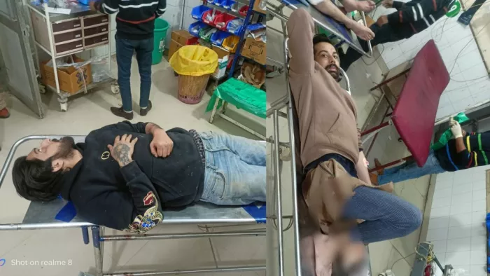 पुलिस की गोली लगन से घायल हुए दोनों बदमाश