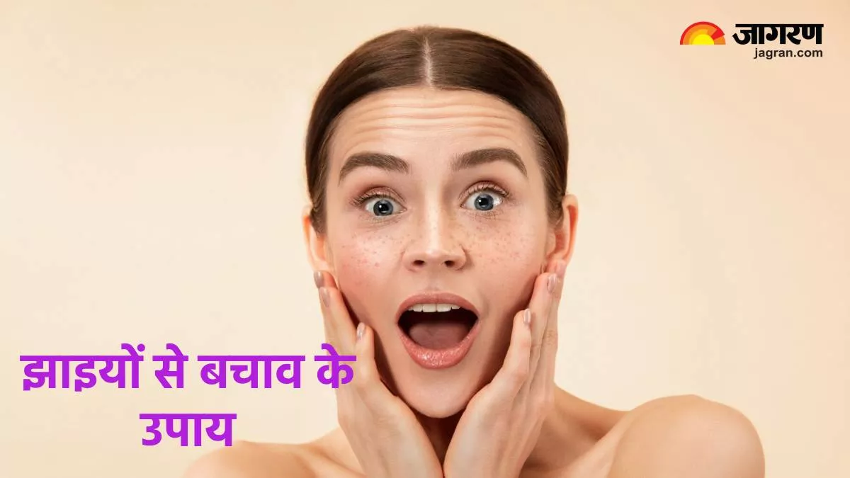 Skin Pigmentation: इन गलतियों से हो सकती है झाइयों की समस्या, बचाव के लिए करें ये काम