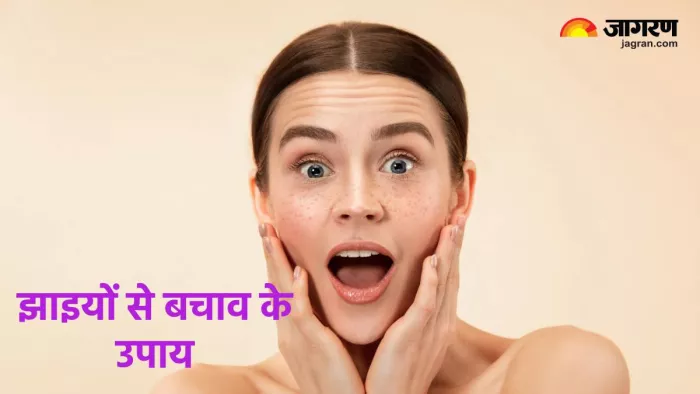 Skin Pigmentation: क्यों होती है झाइयां और कैसे करें इन्हें दूर