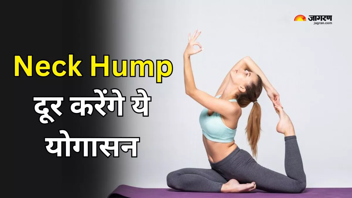 Yoga for Neck Hump: शरीर का बिगड़ रहा है पॉश्चर, निकलता जा रहा है कूबड़, तो ये 5 योगासन करेंगे मदद
