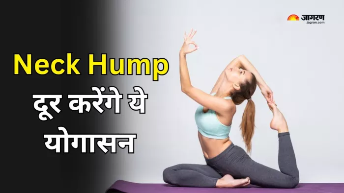 गर्दन की कूबड़ ठीक करने में मददगार है योग (Picture Courtesy: Freepik)