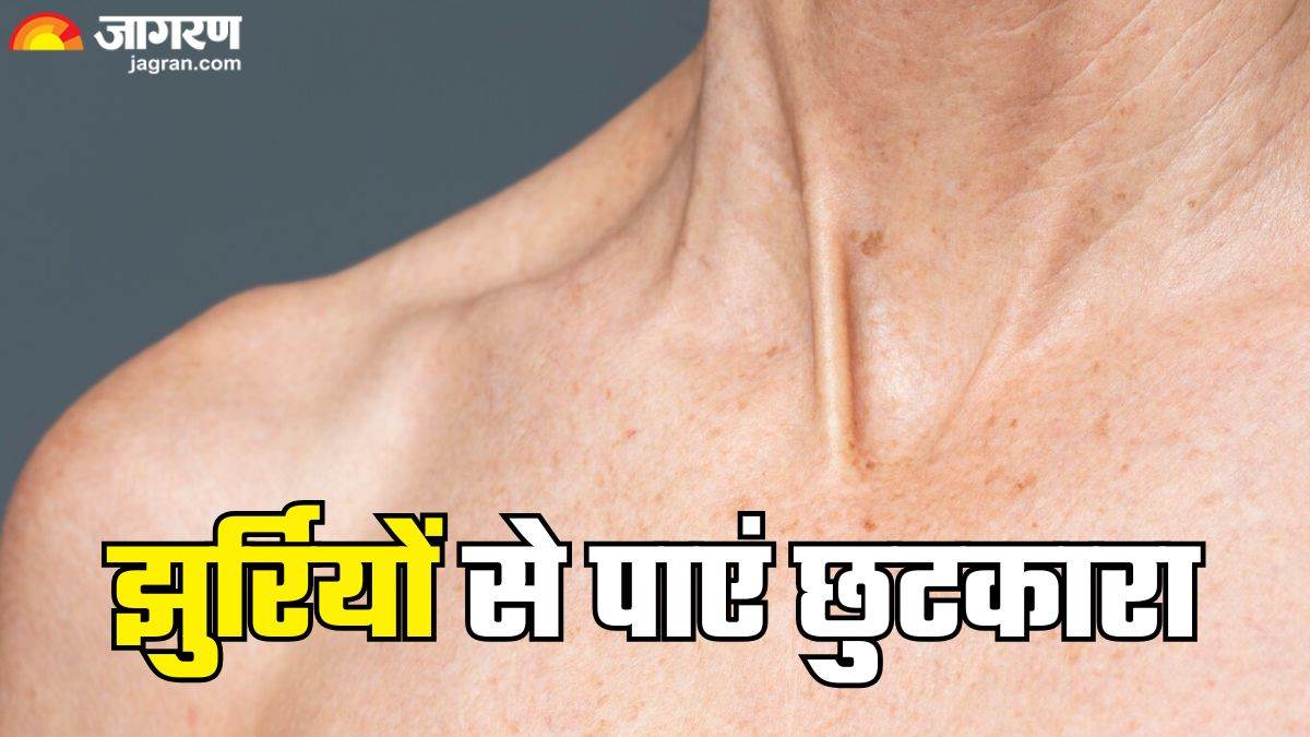 https://www.jagranimages.com/images/newimg/09052025/09_05_2025-wrinkles_remedies_23934188.jpg