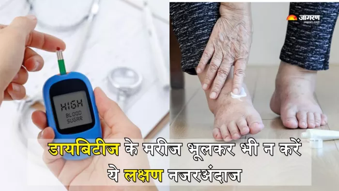 ये होते हैं Diabetic Foot के लक्षण (Picture Courtesy: Freepik)