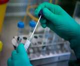 Lucknow Coronavirus Update: मंडी सचिव समेत छह कर्मी कोरोना संक्रमित मिले, गल्ला कारोबारी भी चपेट में