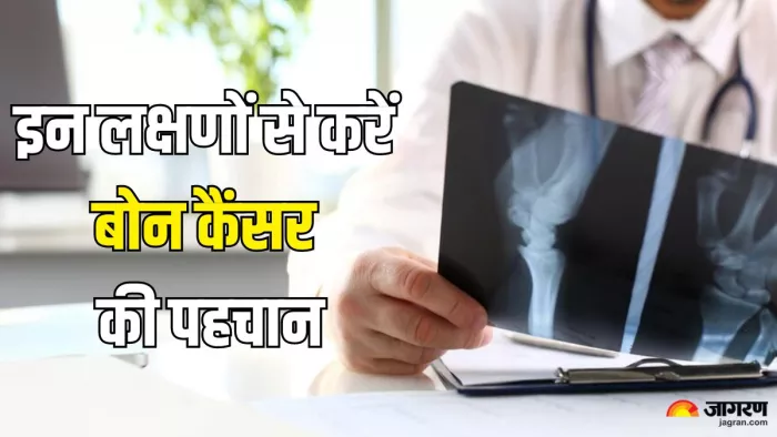 डॉक्टर से जानें हड्डी के कैंसर के लक्षण और इलाज के तरीके (Picture Credit- Freepik)