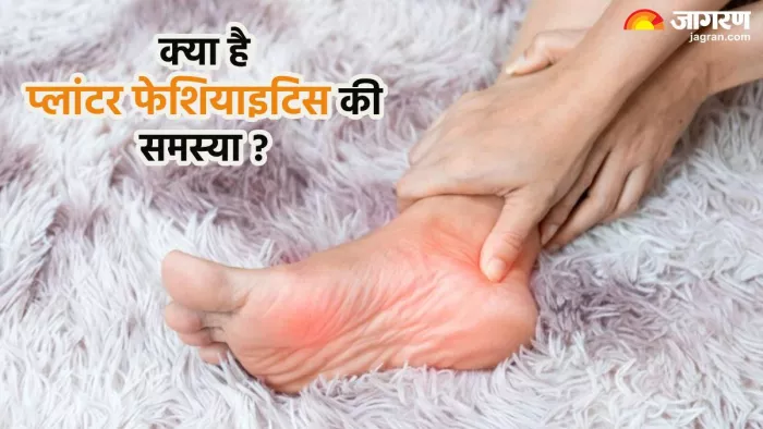 प्लांटर फेशियाइटिस की वजह व लक्षण (Pic credit- freepik)