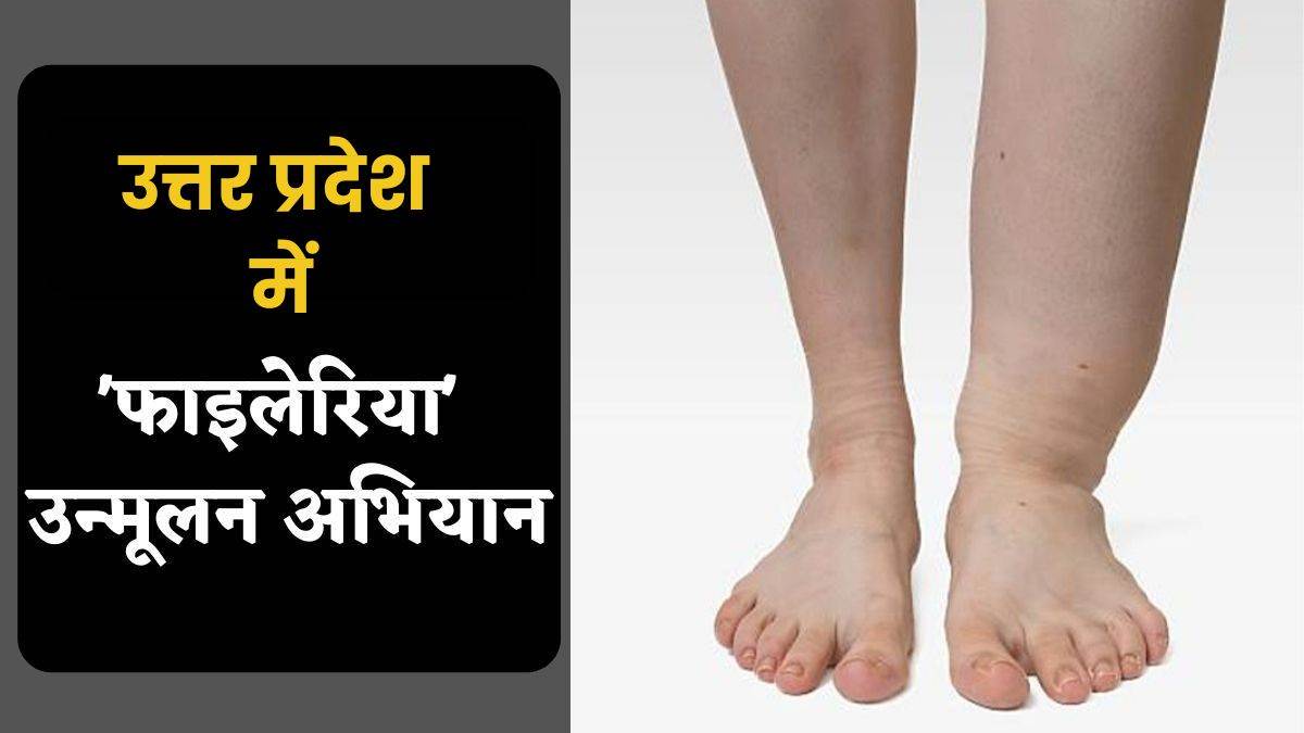 filaria prevention mass drug administration campaign in kannauj