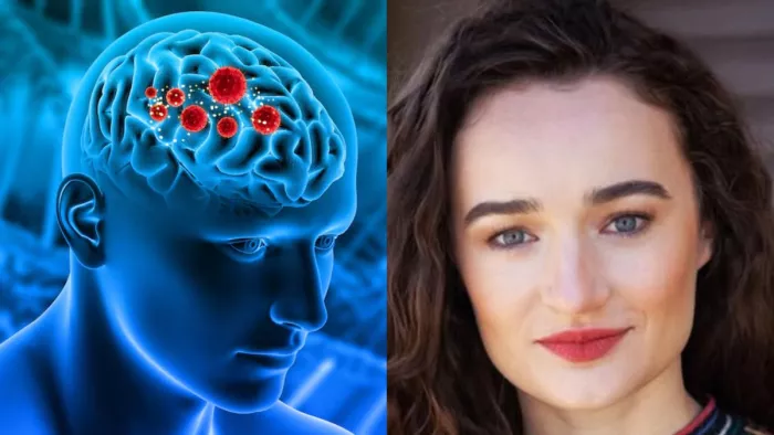 क्या होती है Glioma नाम की बीमारी? (Image Credit- Freepik/Instagram)