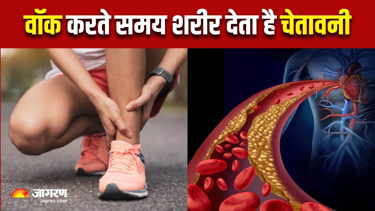 https://www.jagranimages.com/images/newimg/09082025/09_08_2025-high_cholesterol_symptoms_24008323.jpg
