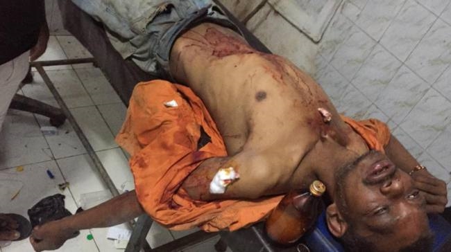 the teacher stabbed the rickshaw driver in chhapra for asking for rent