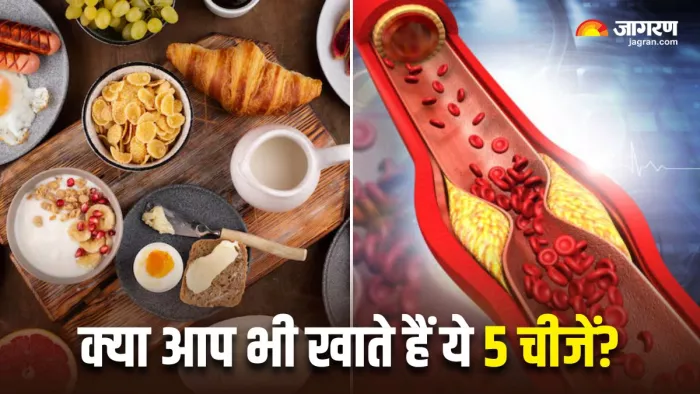 नाश्ते में क्या खाने से बढ़ सकता है कोलेस्ट्रॉल? (Image Source: Freepik)