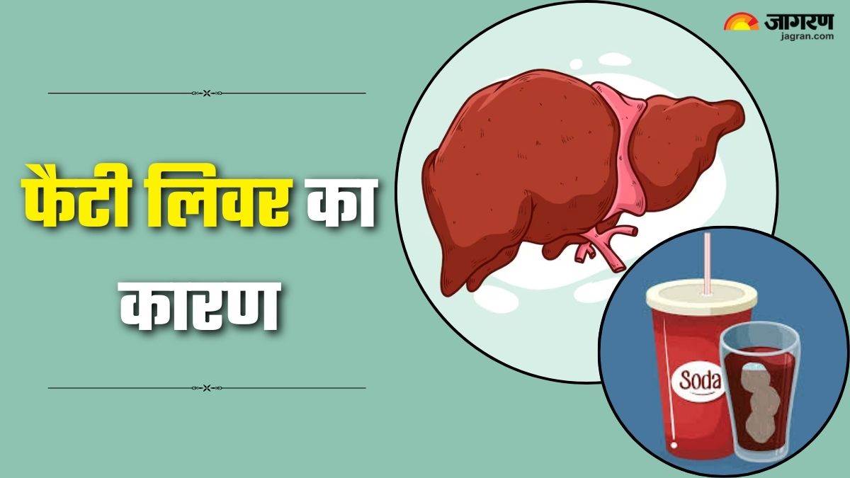 https://www.jagranimages.com/images/newimg/09092025/09_09_2025-fatty_liver_24041221.jpg