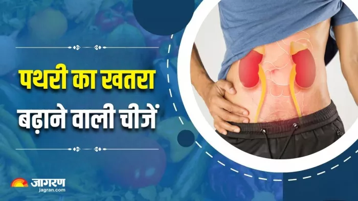 इन 5 चीजों को खाने से बढ़ जाता है पथरी का खतरा, आज ही बना लें दूरी (Image Source: Freepik)