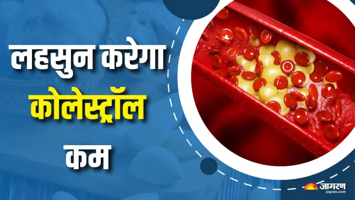 कोलेस्ट्रॉल कम करने के लिए खाएं लहसुन (Picture Courtesy: Freepik)