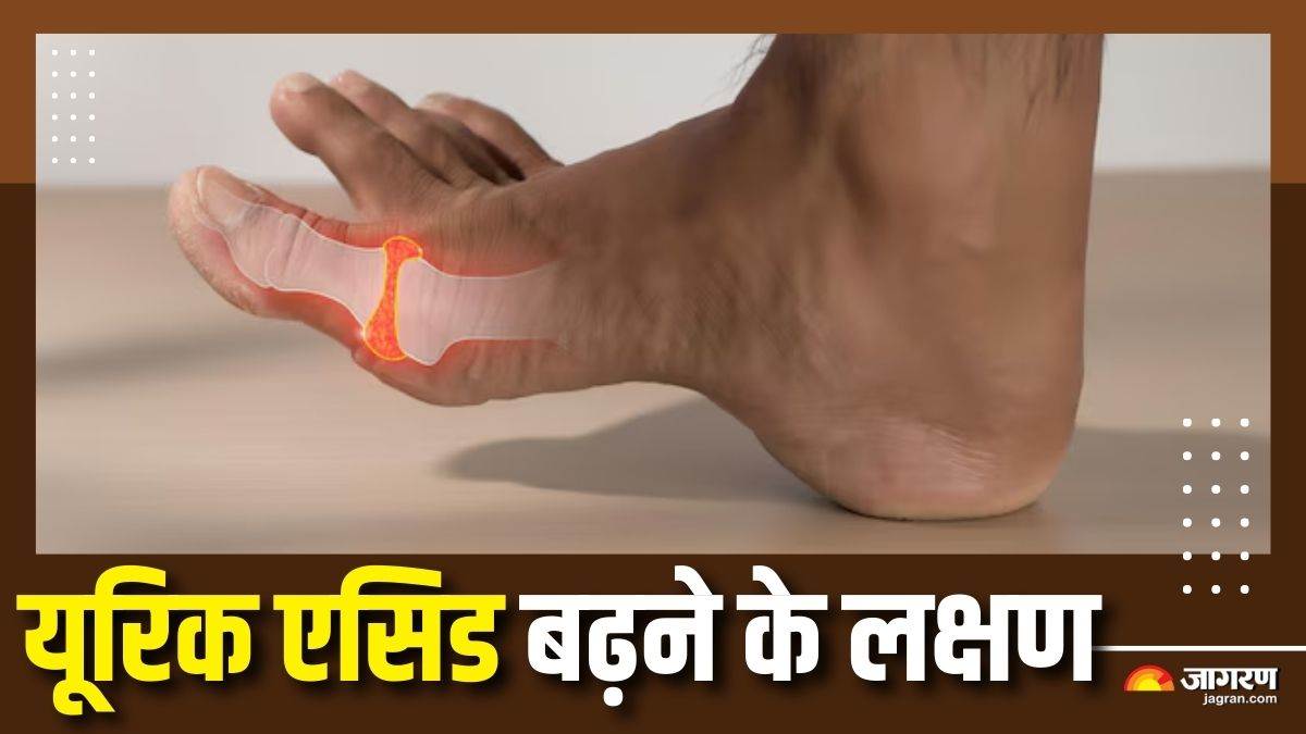 https://www.jagranimages.com/images/newimg/09092025/09_09_2025-high_uric_acid_symptoms_1_24040701.jpg