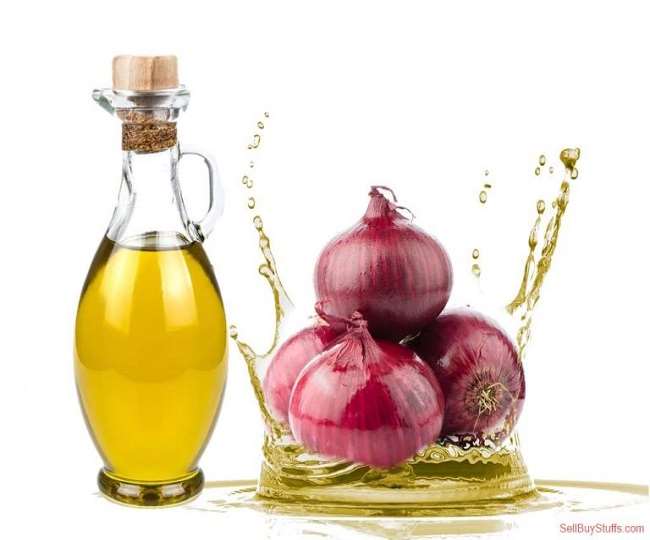 Hair Fall Solution : सर्दी में हेयर फॉल से परेशान है तो प्याज का ऑयल लगाएं,  जानिए फायदे - Onions for Hair Fall An Inexpensive Way to Promote Hair Growth