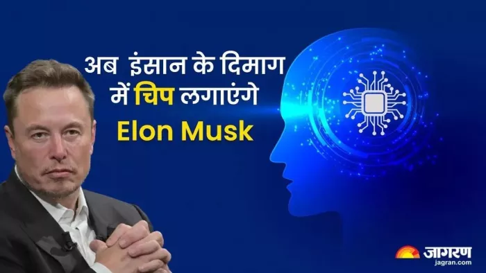 ब्रेन इंप्लांटेशन के लिए तैयार है हजारों लोग, Elon Musk ने की तैयारी