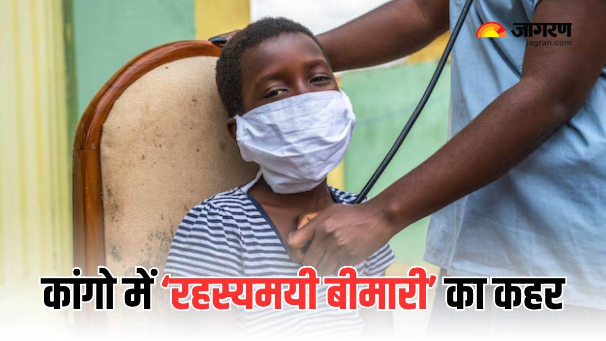 https://www.jagranimages.com/images/newimg/09122024/09_12_2024-mysterious_disease_in_congo_23844851.jpg
