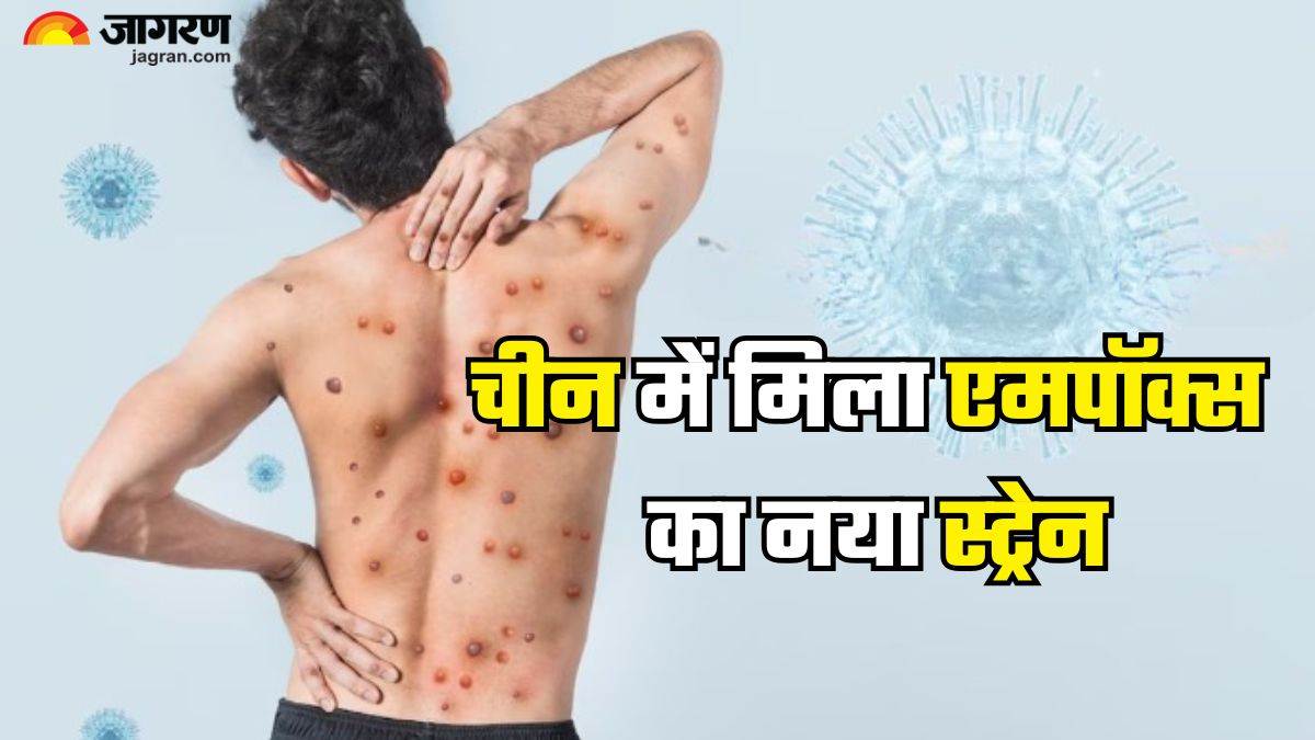 https://www.jagranimages.com/images/newimg/10012025/10_01_2025-mpox_new_strain_23864355.jpg