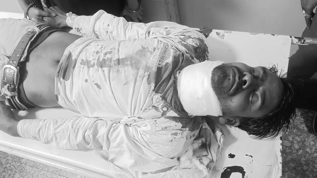 Gorakhpur News: पेशी पर आए बंदी ने लॉकअप में चाकू से रेता अपना गला, भाई की हत्या के आरोप में चल रहा मुकदमा