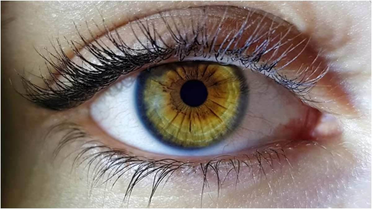 woman in hyderabad lost vision due to smartphone use in the dark