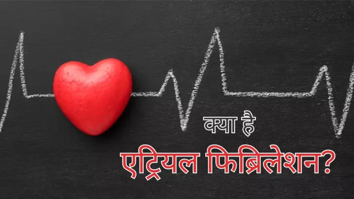 क्या है Atrial Fibrillation, एक्सपर्ट से जानें इसके बारे में सबकुछ