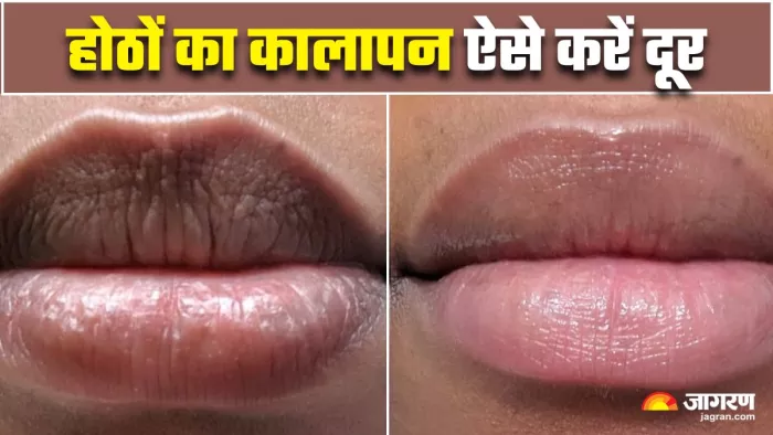 Pigmented Lips से राहत दिलाएंगे 5 नेचुरल स्क्रब्स (Image Source: Freepik)