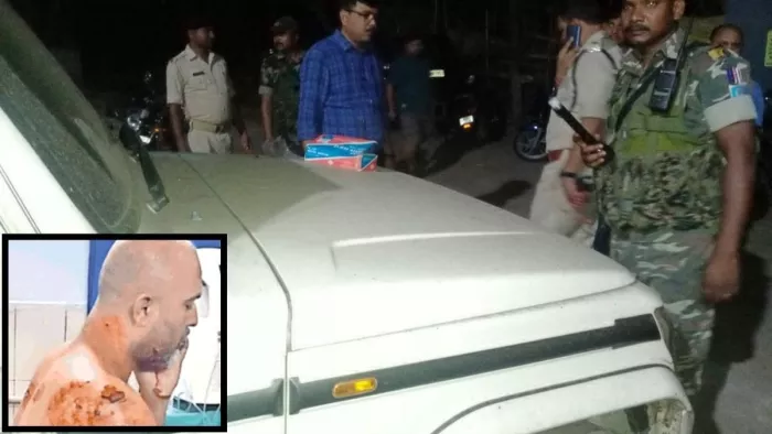 टीएमएच में इलाजरत अजय प्रताप सिंह और इसी वाहन के पास फेंका गया बम।