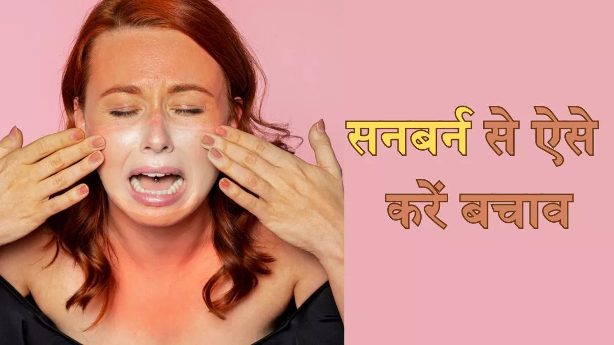 Sunburn की वजह बन सकती है झुलसाने वाली धूप, इन टिप्स की मदद से गर्मियों में रखें अपनी त्वचा का खास ख्याल