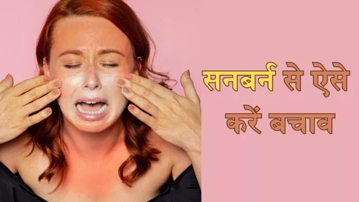 गर्मियों में इन तरीकों से करें सनबर्न से बचाव (Picture Credit- Freepik)