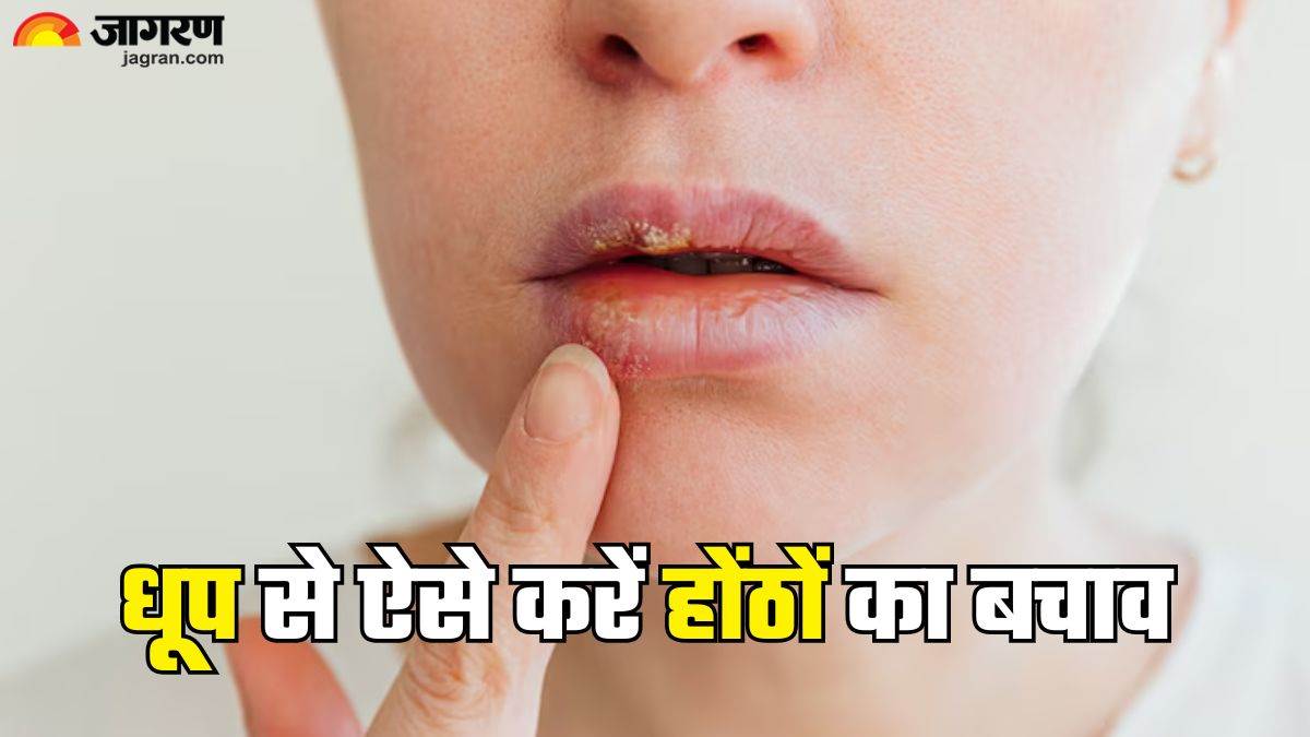 https://www.jagranimages.com/images/newimg/10062025/10_06_2025-sunburn_lips_23960670.jpg